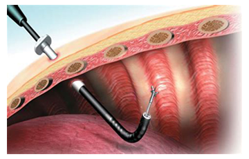 THORACOSCOPY test in noida