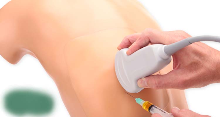 Best Doctors for Thoracentesis in Noida